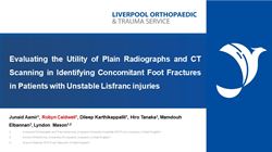 Evaluating the utility of plain radiograph and computerised tomography scanning in identifying concomitant foot fractures in patients with unstable Lisfranc injuries