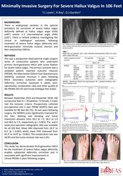 Minimally invasive surgery for severe hallux valgus in 106 feet