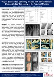 Correction of valgus lesser toe deformity using a closing wedge osteotomy of the proximal phalanx: percutaneous technique and 2 year results
