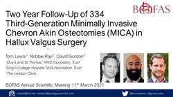 Two year follow-up of 334 third-generation Minimally invasive Chevron Akin Osteotomies (MICA) in hallux valgus surgery