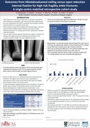 Outcomes from tibiotalocalcaneal nailing versus open reduction internal fixation for high-risk fragility ankle fractures: a single-centre matched retrospective cohort study