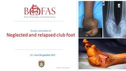 Neglected and relapsed clubfoot in adults, the functional outcome of acute surgical correction