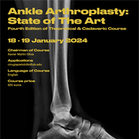 Ankle arthroplasty: the state of the art