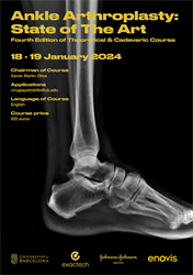 Ankle arthroplasty: the state of the art