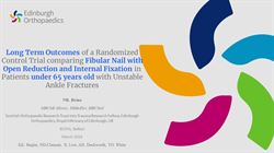 Long term outcomes of a randomized control trial comparing fibular nail with open reduction and internal fixation in patients with unstable ankle fractures