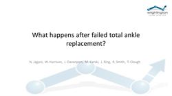 What happens after failed total ankle replacement?