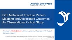 Fifth Metatarsal Fracture Pattern Mapping and Associated Outcomes - An Observational Cohort Study