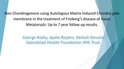Neo-Chondrogenesis Using Autologous Matrix Induced Membrane (AMIC) In The Treatment Of Freiberg's Disease Of Lesser Metatarsals Up To 7 Year Follow Up Results