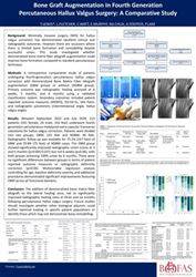 Bone Graft Augmentation in Fourth Generation Percutaneous Hallux Valgus Surgery