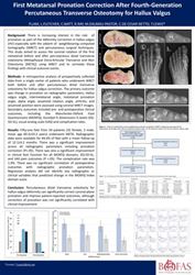 First Metatarsal Pronation Correction After Fourth-Generation Percutaneous Transverse Osteotomy for Hallux Valgus