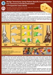 Wedge Tarsectomy using Patient Specific Instrumentation in a Tertiary Foot and Ankle Unit