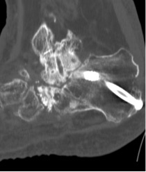 BOFAS > Hyperbook > Radiology > 9. Advanced Imaging